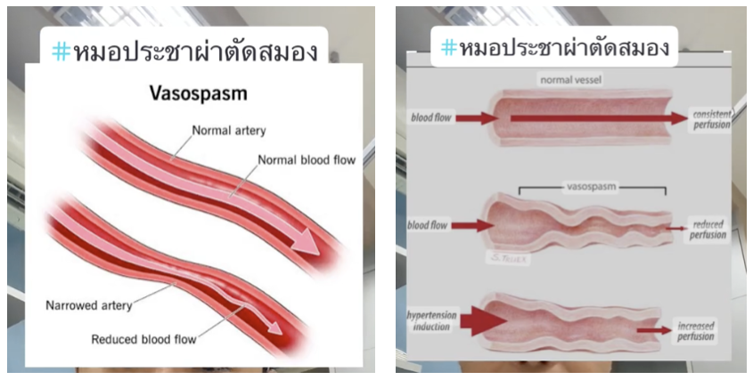 Screenshot-2568-09-30-at-20.11.22.png